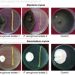 Evaluation of phyllosphere bacterial biocontrol agents for the suppression of rice foliar diseases